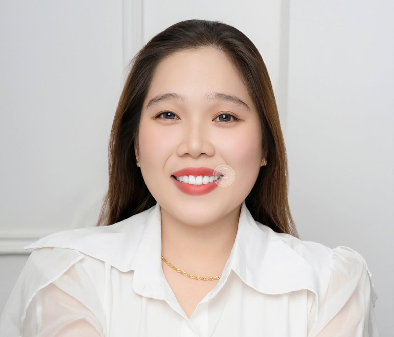 5 phương pháp làm răng thẩm mỹ ưa chuộng nhất 2025: Đâu là lựa chọn cho bạn?